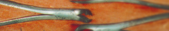 Illustrative image